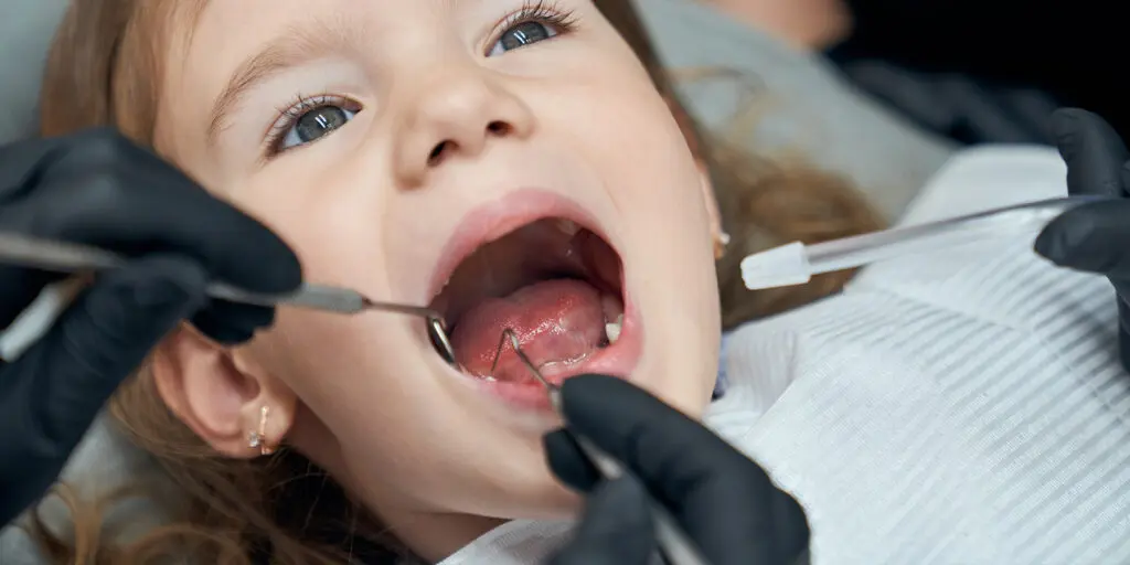 What Causes Cavities and How Tooth Decay Is Treated