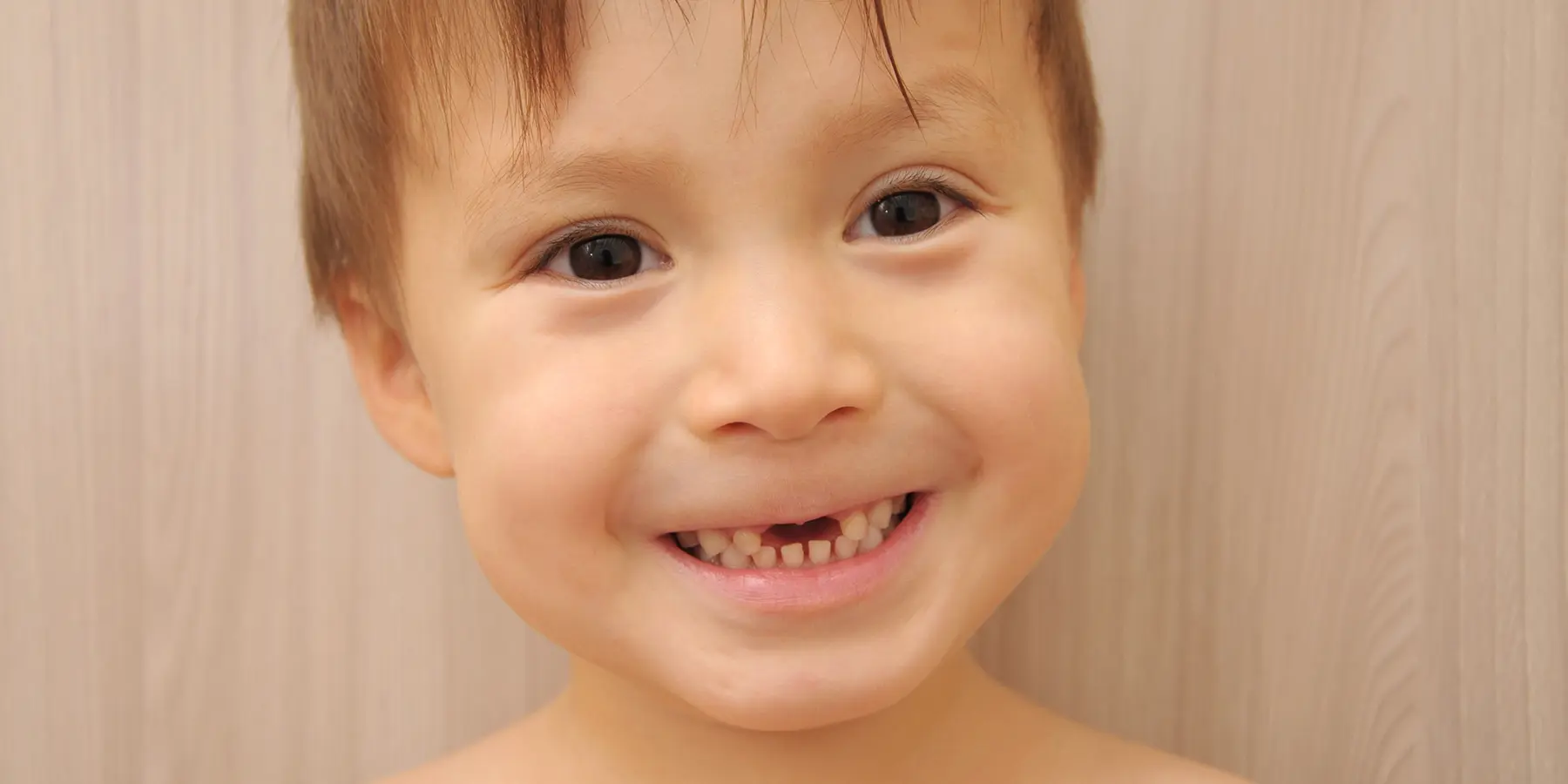 When a Baby Tooth Falls Out Too Soon: Space Maintainers Explained