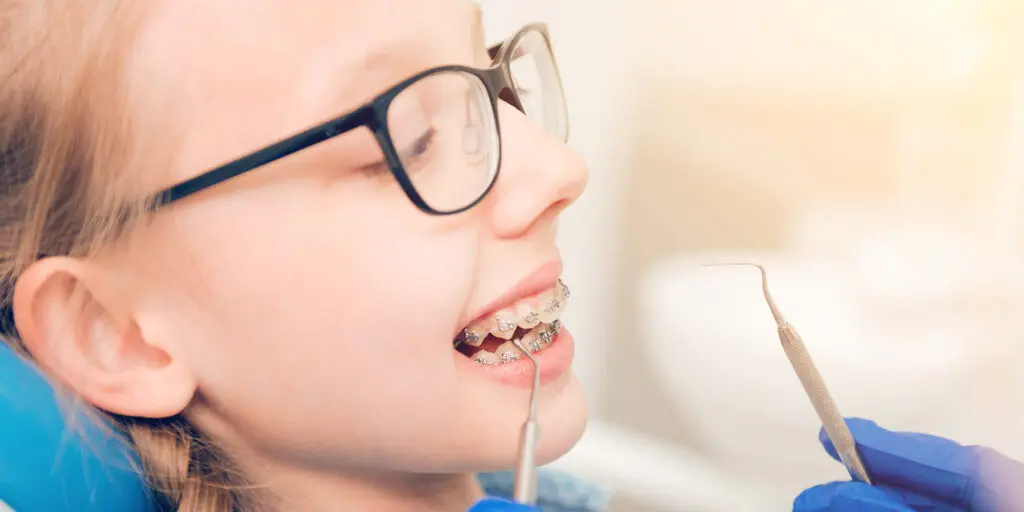 The Best Age for Braces (and Why It’s Different for Every Child)