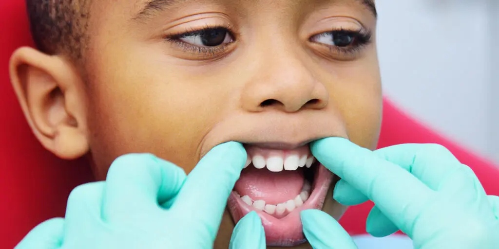 Little Teeth, Big Impact: Why Baby Teeth Matter More Than You Think