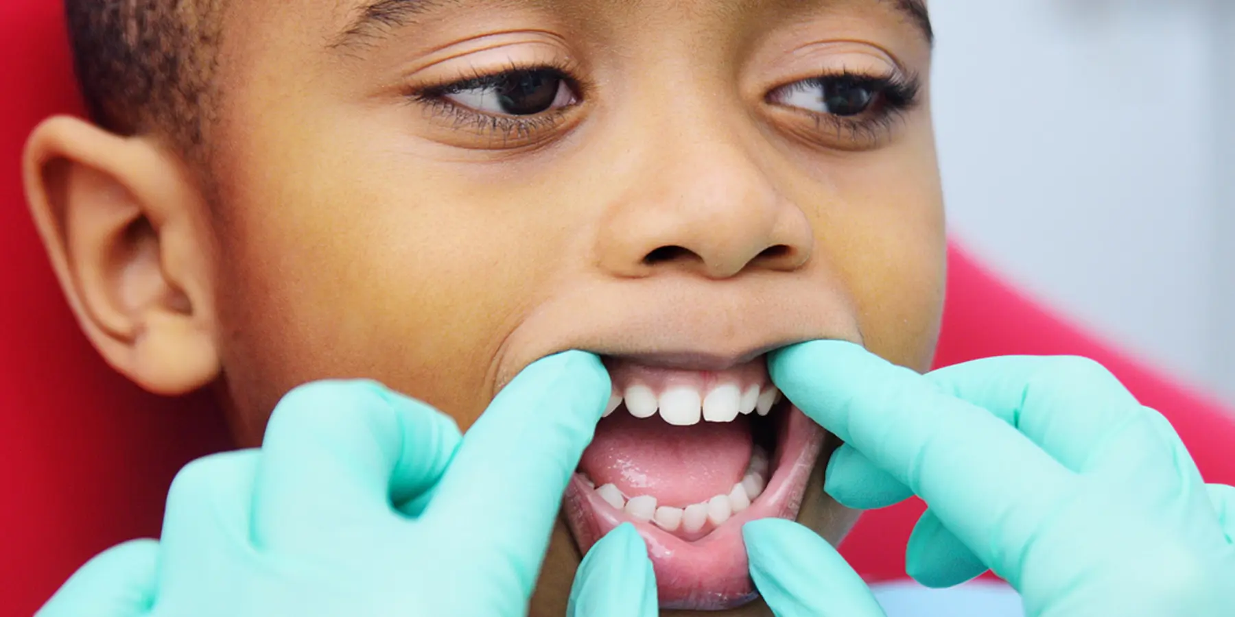 Little Teeth, Big Impact: Why Baby Teeth Matter More Than You Think