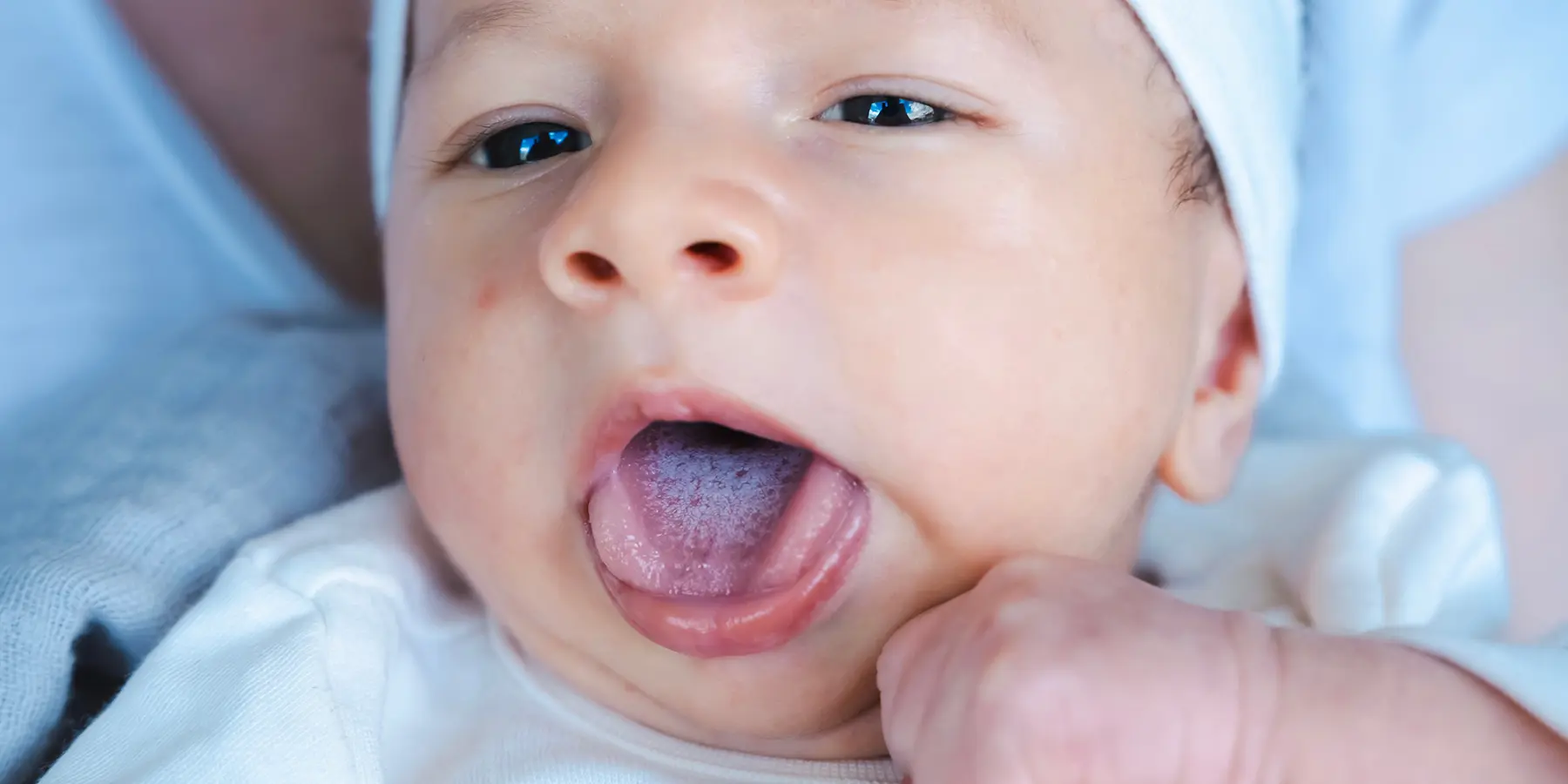 Milk Tongue vs. Thrush: How to Tell the Difference
