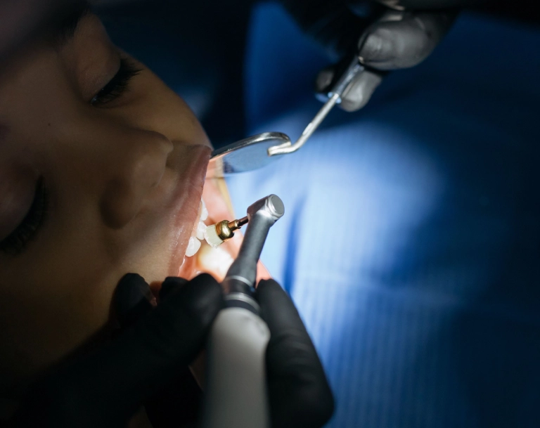 Dental Visits From the First Tooth Through the Teen Years